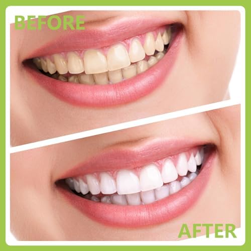 PARYUNGR Dental Care Kit with Storage Box