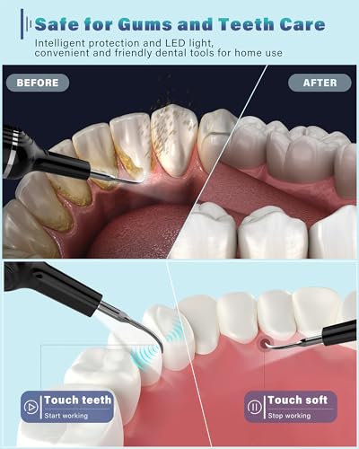 Nature Nerds Plaque Remover Dental Kit with LED Light