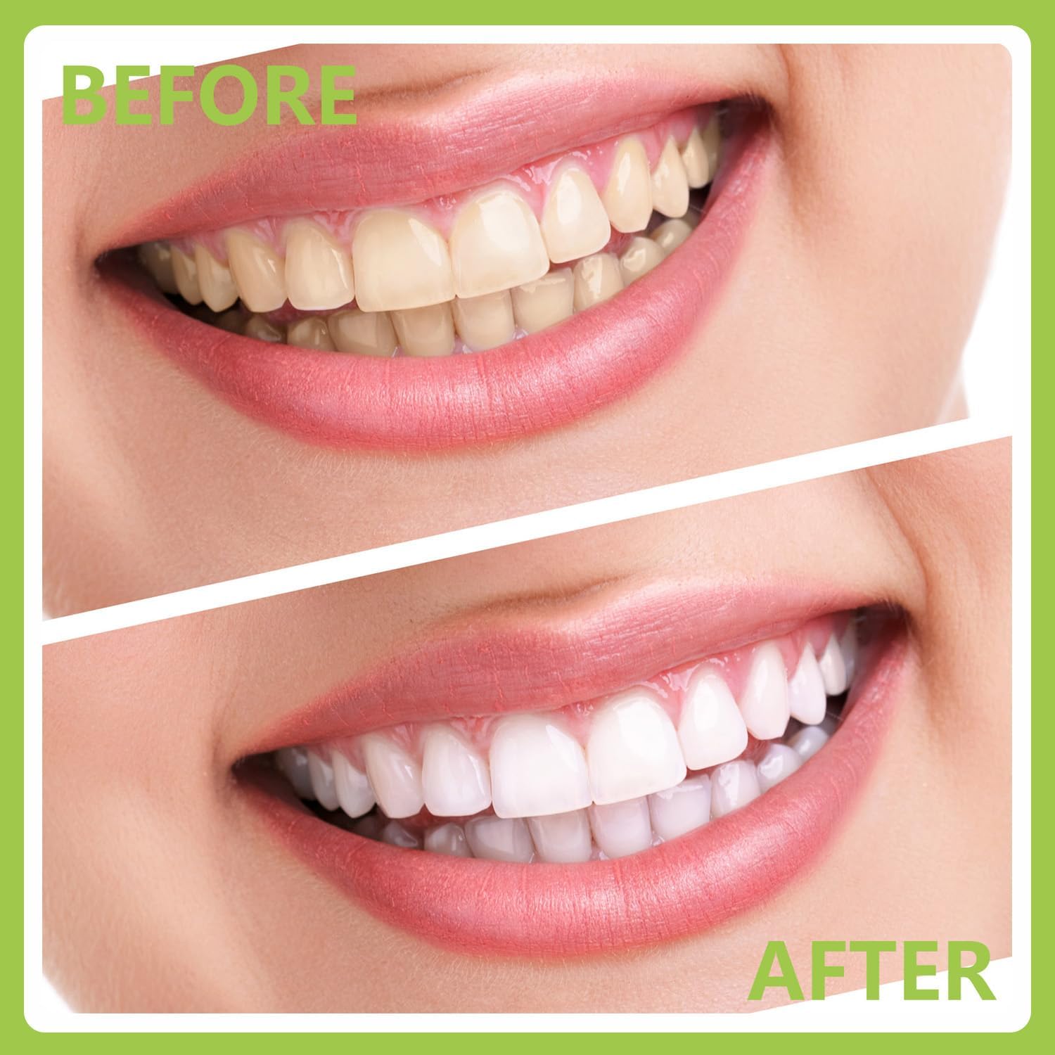 PARYUNGR Dental Care Kit with Storage Box